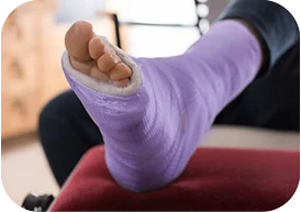 Broken Foot and Ankle Treatment Hialeah, FL 33018